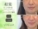 シーズボーテ(C's Beaute)の写真