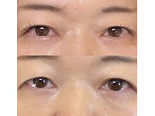 左右非対称様もお任せください！片目ずつデザインいたします:D