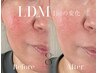 【6月末まで】大人気！水玉リフトLDMツヤ肌コース/エレポ冷却導入付き ¥9900