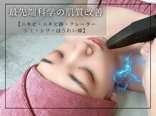 レッド(RED)の雰囲気（小顔矯正で骨格、頭皮からアプローチして輪郭形成！即日効果実感）