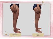 ヌーン(noon)/下半身太り解消