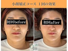 キュープ 表参道店(Qpu)/続けた方しか感じられない変化♪