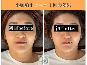 キュープ 表参道店(Qpu)/続けた方しか感じられない変化♪