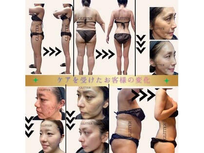 グリッター(GLITTER)の写真