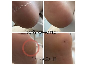 レア(Lea)/フットディープケア