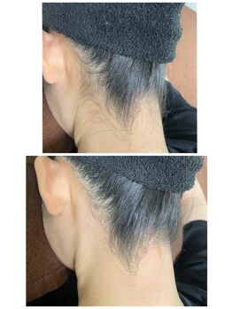 エン(en.)/BeforeAfter写真30