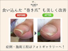 巻き爪補正店 横浜関内店の雰囲気（痛みのある巻き爪を痛みなく改善へ☆症例はフォトギャラリーへ！）