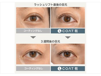 アオ(ao)/Lコート(エルコート)