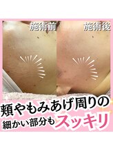 ホワイトワックス 名古屋金山店(WHITE WAX)/もみあげ