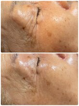 イルソーレ(IL Sole)/年齢が気になる皮膚の薄い部分も