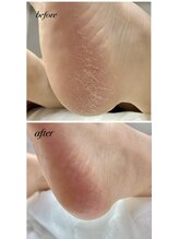 ラヴィ(La vie)/ハワイ旅行その前に