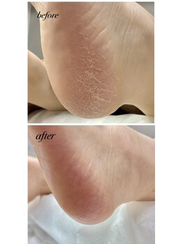 ラヴィ(La vie)/ハワイ旅行その前に