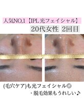 アースコアフュールボーテ ひたち野うしく店(EARTH coiffure beaute)/光フェイシャルで毛穴ケア