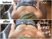 つばききよら/１度でここまで！変化が出ました