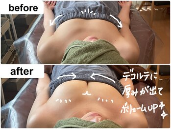 つばききよら/１度でここまで！変化が出ました