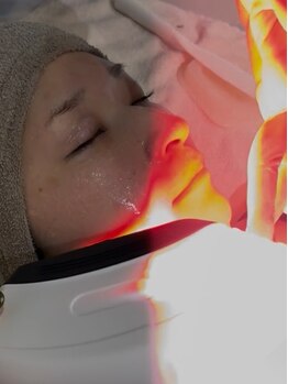 ル ボヌール/最新IPL光フェイシャル