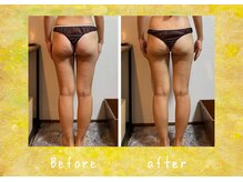 マタハリ(Matahari)/4D筋膜リリース