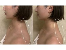 リフテグレース(LIFTE Grace)/深層マッサージ