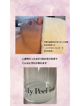 ロビアンサロン(ROVIAN SALON)/☆Hy Peel into☆
