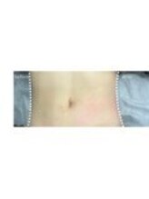 小顔・痩身専門店Lift（リフト）練馬/小顔専門店Lift|Before After