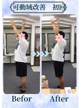 アミーゴ整体院/ビフォーアフター