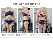 プレズィール(Plaisir)