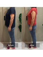 ヨサ パーク コアハート(YOSA PARK CORE HEART)/テラの力