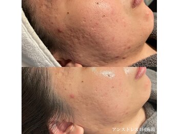 エクラ(eclat)/クリスティーナ／アンストレス