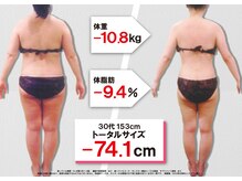 セントラヴィ 上野店/Before After【30代女性(1)】