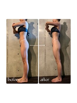 ボーレーヴ 表参道店(beaureve)/施術効果写真(before after)