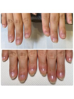 自爪育成　ネイルケア