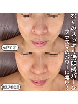 ベルファーム(Belle Femme)/むくみ解消(o^^o)