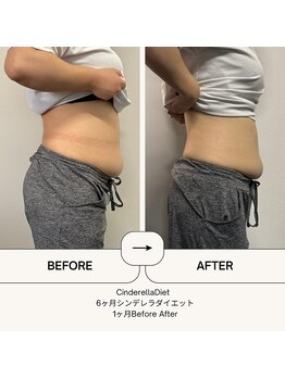 オーシャン整骨院(OCEAN整骨院)/６ヶ月コース