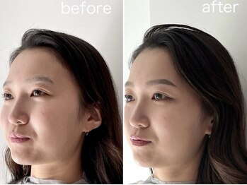 アンバイアオ 本町(UN by ao.)/ビフォーアフター