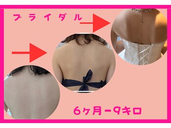 フレクシー/ブライダルのお客様　痩身