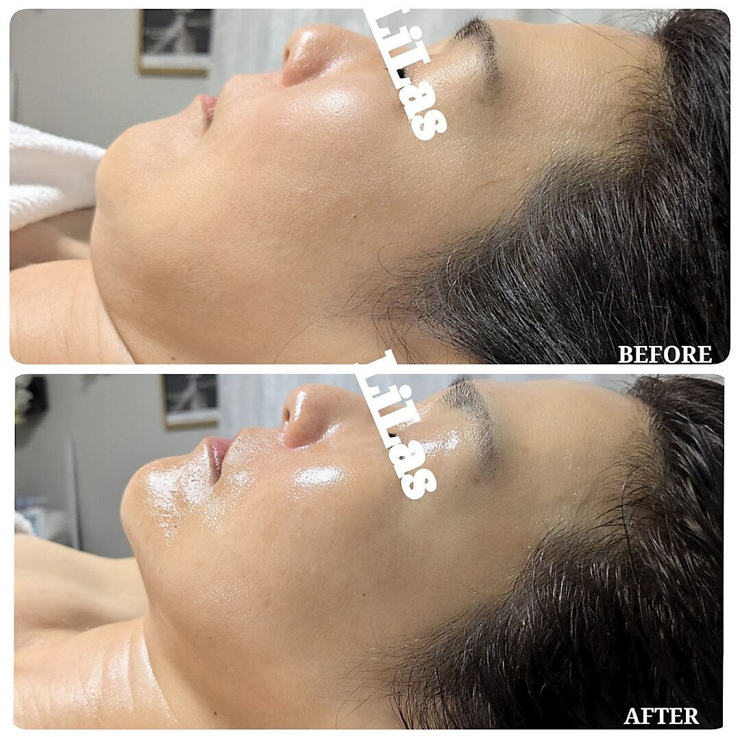 リラ(LiLas)｜ホットペッパービューティー