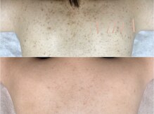 ヴィーダ 渋谷松濤(ViDA)