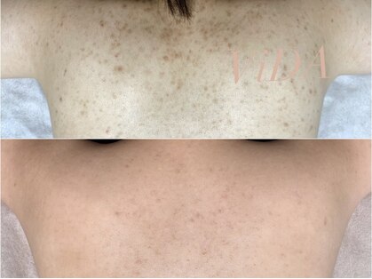 ヴィーダ 渋谷松濤(ViDA)の写真