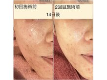 コル(COR)の雰囲気(プラズマの特許施術でお肌の変化も実感☆)