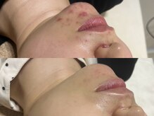 エムフロート(M FLOAT)の雰囲気（お悩みに合わせたメニューをご提供。ニキビ、毛穴お任せください）