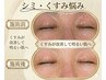 【頑固なシミ悩み】◇美白スペシャルエステ/90分 ※詳細は9/28ブログ