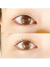 ビューティーホスピタル(Beauty Hospital)/ラッシュリフト