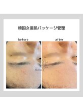 ポムハヌル(pom.haneul)/韓国肌管理室