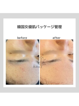 ポムハヌル(pom.haneul)/韓国肌管理室