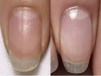 プラスミー(+me)/自爪育成