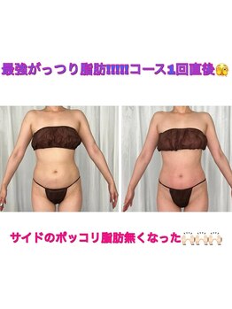 シュシュ エステティックアンドヨガ(chouchou esthetique&yoga)/最強!!!がっつり3時間半コース