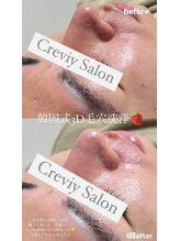 クレヴィー(Creviy)/韓国式3D毛穴洗浄(初回1回)