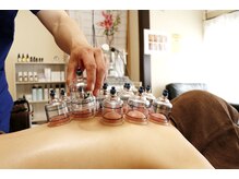 ラディアント(Radiant)/