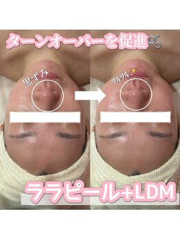 サロン(SALON)/ララピール+LDM