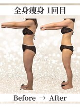 ドレス(dress)/全身痩身Before/After